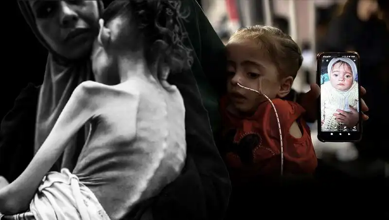 Meryem'in Dramatik Dönüşümü: 25 Kilodan 10 Kiloya Düşüşü ve Açlık Mücadelesi