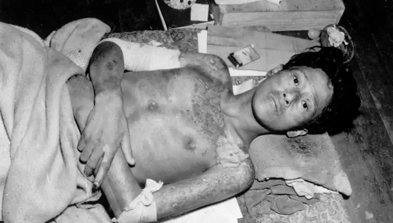 80 Yıl Sonra Nagasaki'den Duyulan Nükleer Felaket Uyarısı
